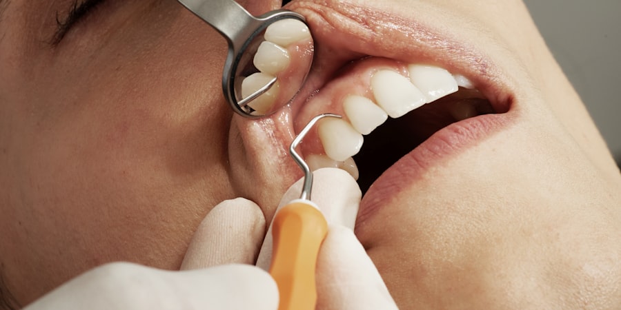 Q&M Dental Group announces new 3Y SGD Senior Notes at an IPG of 4.35%. | Open a FREE FSM account and manage all your investments conveniently in ONE place